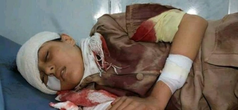 طفلة ضحية قصف الحوثي بمنطقة الصلو بتعز (مكة)