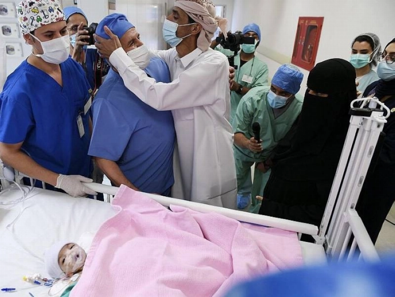 نجاح عملية فصل التوأم الطفيلي اليمني (واس)