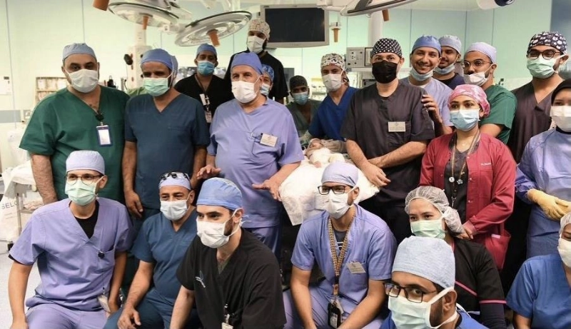 نجاح عملية فصل التوأم الطفيلي اليمني (واس)