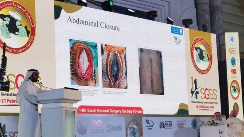 الملتقى العلمي الرابع عشر للجمعية السعودية للجراحة يختتم فعالياته بعدد من التوصيات التخصصية