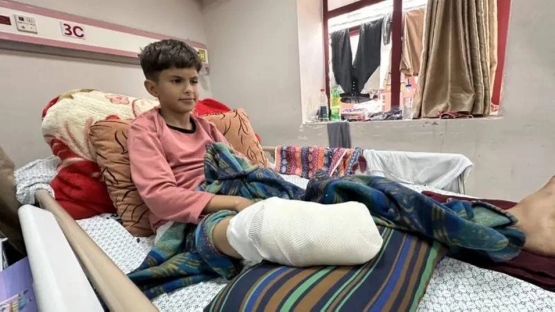 طفل تعرض لإعاقة بسبب قنبلة إسرائيلية خفية