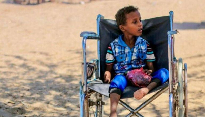 طفل يمني معاق بسبب الألغام (مكة)