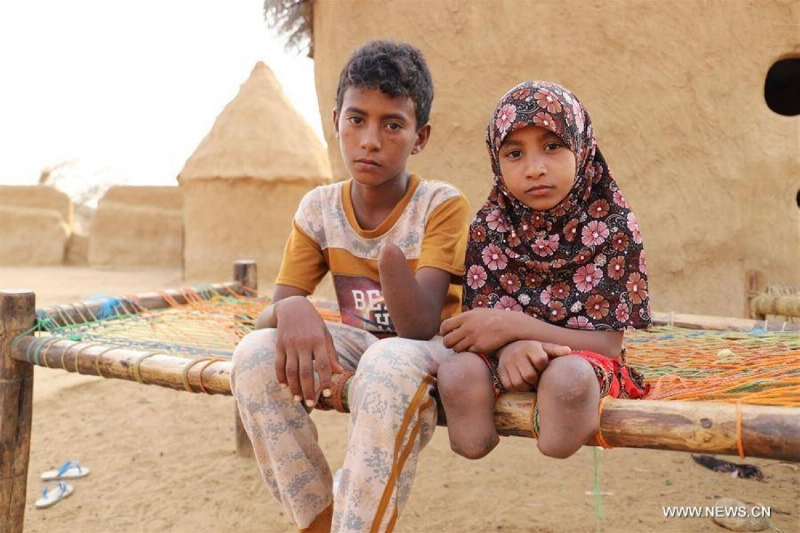 طفلان من ضحايا الألغام في اليمن (مكة)