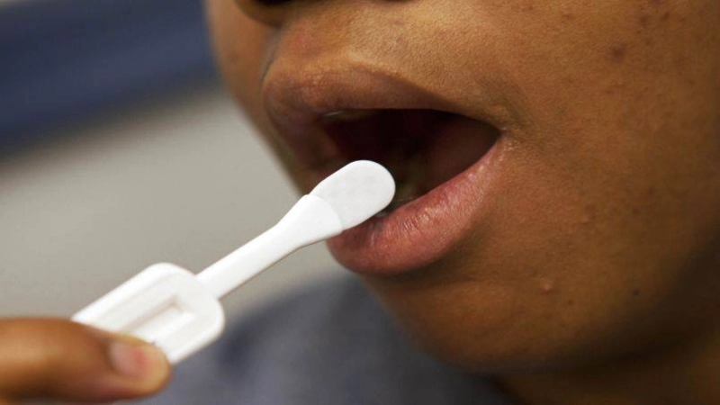 Les autotests VIH vendus en pharmacies