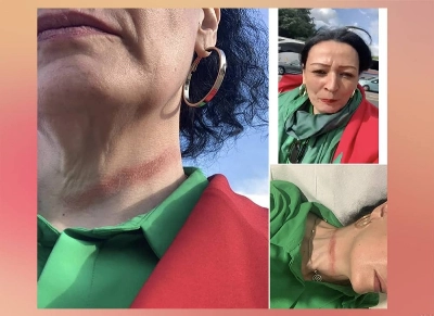 La trace de la strangulation de Houda Belkadi El Haloui est bien visible