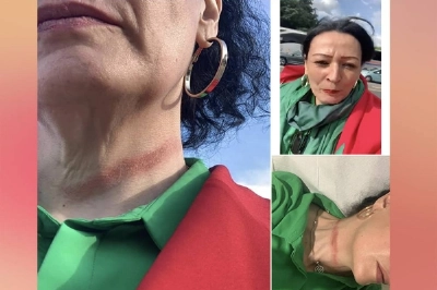 La trace de la strangulation de Houda Belkadi El Haloui est bien visible