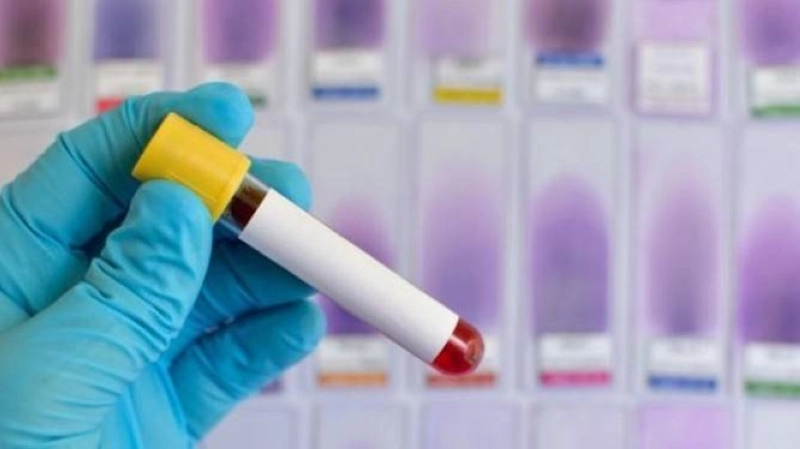 Le test PCR n'est plus obligatoire pour accéder au Maroc