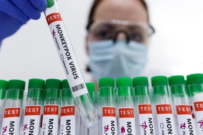 L'OMS a recenssé au 31 août dernier 31 août 50.496 cas de variole du singe dans le monde et et 16 décès