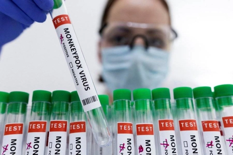 L'OMS a recenssé au 31 août dernier 31 août 50.496 cas de variole du singe dans le monde et et 16 décès
