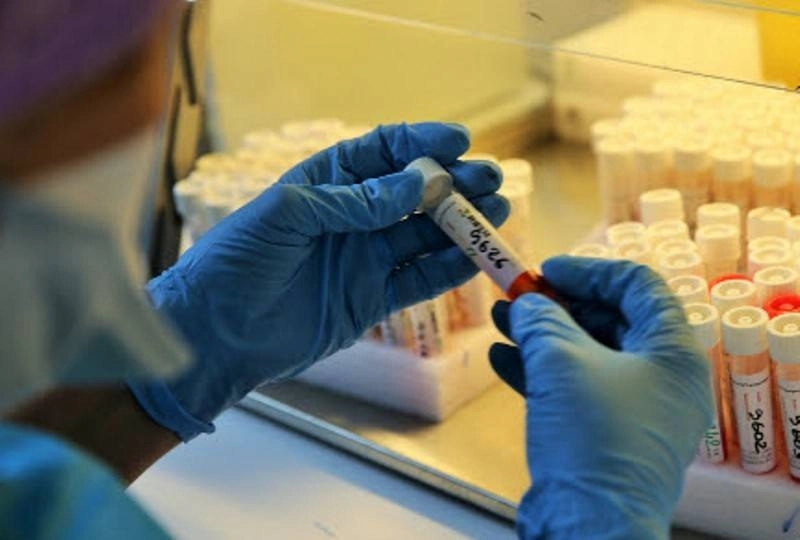 Le ministère dément les informations sur l'Omicron-XBB, affirmant la normalité de la situation épidémiologique au pays.