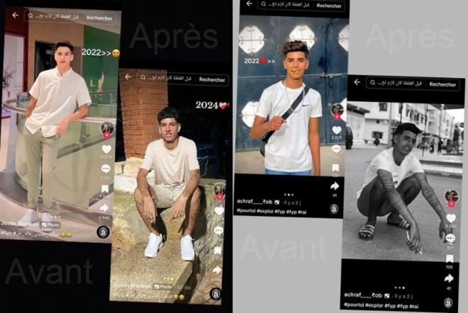 Avec courage, ces jeunes montrent leur métamorphose à cause de l'addiction