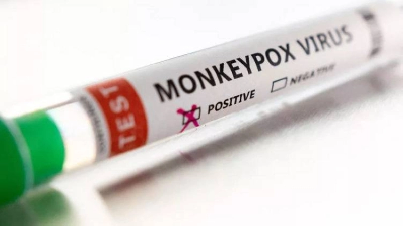 Mpox, le come-back inquiétant