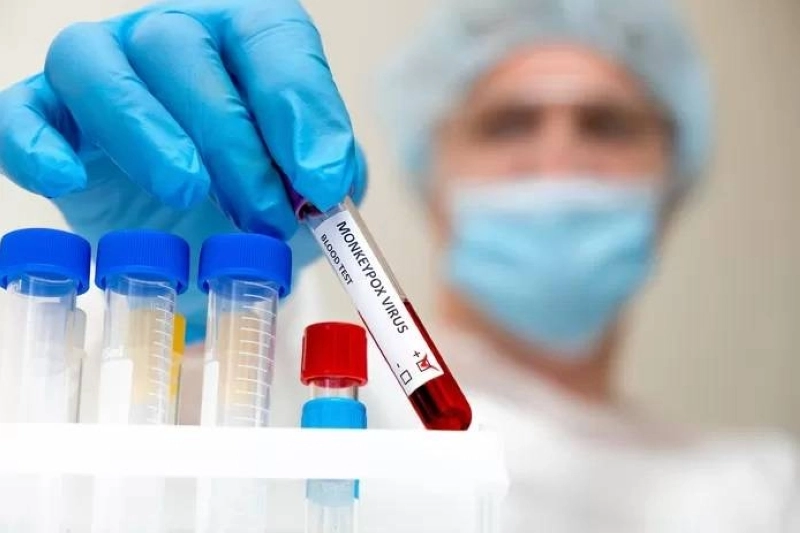 Le virus du Mpox peut être mortel