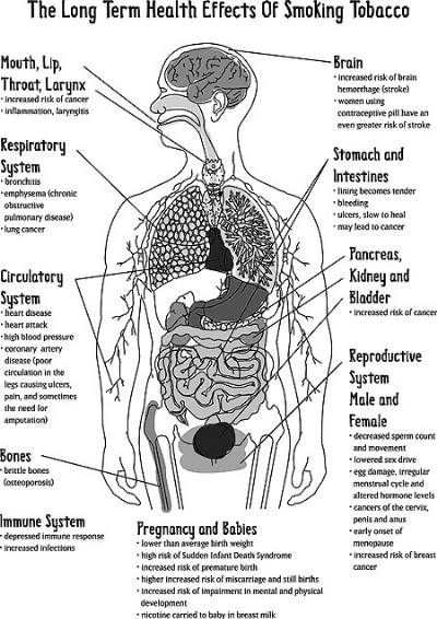 is tobacco harmful PPT - The Harmful Effects of Tobacco PowerPoint Presentation, free download is tobacco harmful PPT - The Harmful Effects of Tobacco PowerPoint Presentation, free download