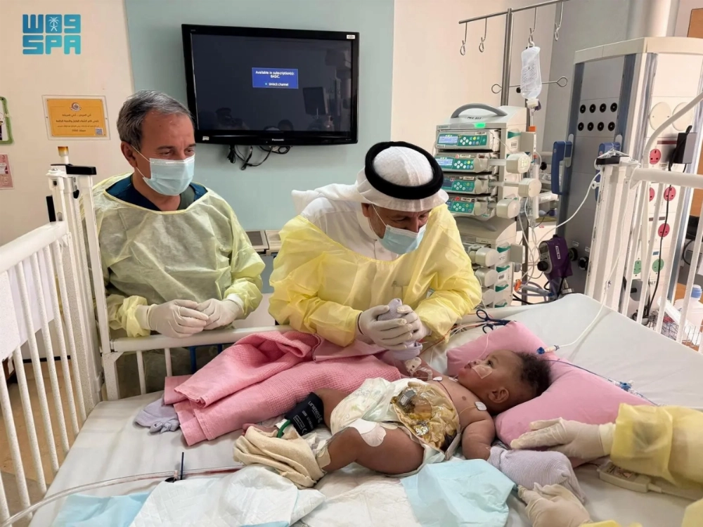 Dr. Abdullah Al-Rabeeah is visiting the Somali conjoined twins Rahma and Ramla at the King Abdullah Specialized Children’s Hospital in Riyadh.