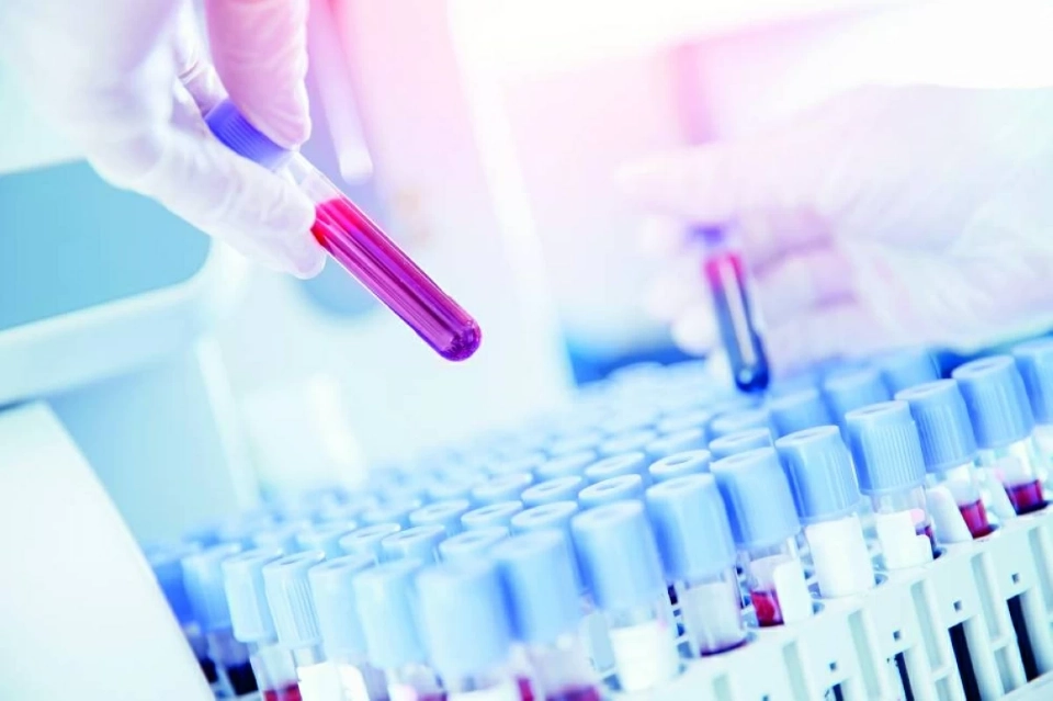 سحب دراسة مثيرة للجدل حول الوفيات الزائدة خلال جائحة كوفيد-19