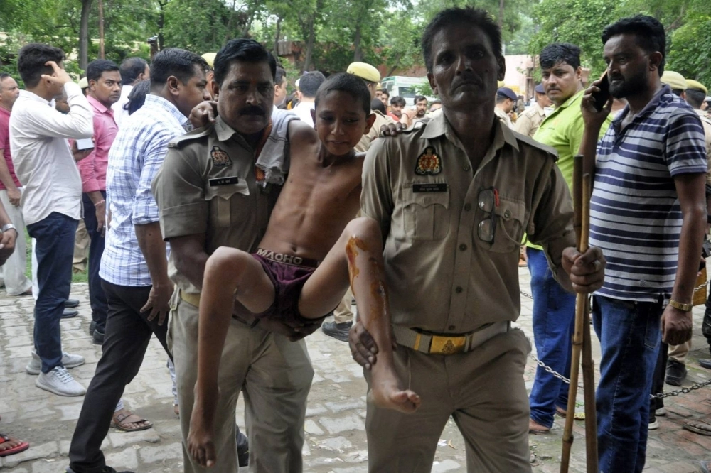 A boy injured in a stampede at a religious gathering reacts as he is brought to a hospital in the northern state of Uttar Pradesh, India, on Tuesday. A boy injured in a stampede at a religious gathering reacts as he is brought to a hospital in the northern state of Uttar Pradesh, India, on Tuesday.