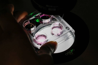 A medical technician selects eggs for an in vitro fertilization (IVF) procedure Paris in 2019. A medical technician selects eggs for an in vitro fertilization (IVF) procedure Paris in 2019.