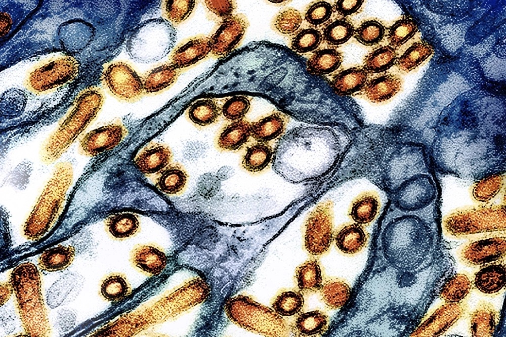 In an image provided by federal agencies, a colorized electron microscope image shows avian influenza grown in cultured cells. The virus is poised to become a permanent presence in cattle, raising the odds of an eventual outbreak among people. In an image provided by federal agencies, a colorized electron microscope image shows avian influenza grown in cultured cells. The virus is poised to become a permanent presence in cattle, raising the odds of an eventual outbreak among people.