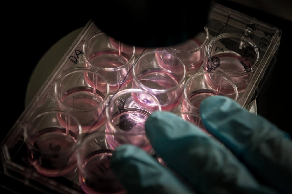 Kyoto University's CiRA Foundation will automatically make autologous induced pluripotent stem cells and turn them into heart muscle and nerve cells at a new facility in the city of Osaka starting in April. Kyoto University's CiRA Foundation will automatically make autologous induced pluripotent stem cells and turn them into heart muscle and nerve cells at a new facility in the city of Osaka starting in April.