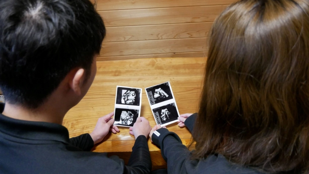 Expectant parents Masataka and Saki Ohita look at ultrasound images of their unborn twins. Expectant parents Masataka and Saki Ohita look at ultrasound images of their unborn twins.