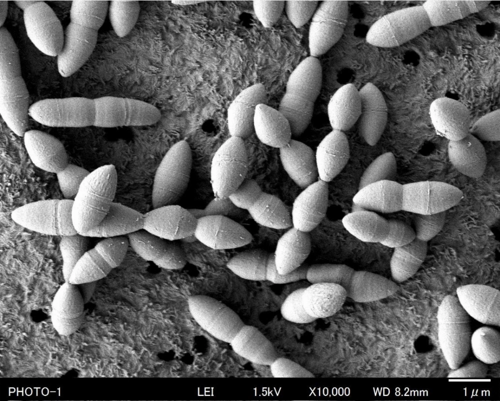 Researchers at the National Cancer Center Japan say a new type of gut bacteria named YB328 could help unlock the potential of cancer immunotherapy. Researchers at the National Cancer Center Japan say a new type of gut bacteria named YB328 could help unlock the potential of cancer immunotherapy.