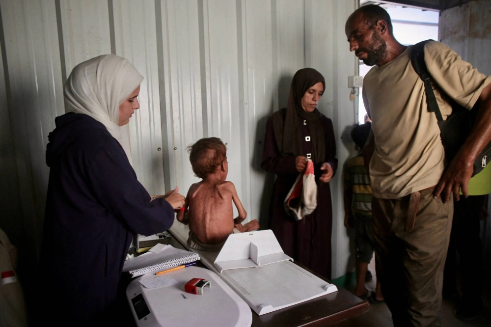 A malnourished Palestinian child gets a checkup at a medical point run by a local nongovernmental organization affiliated with the primary health care of the Palestinian health ministry in al-Mawasi, in the southern Gaza Strip district of Khan Younis, on Aug. 13. A malnourished Palestinian child gets a checkup at a medical point run by a local nongovernmental organization affiliated with the primary health care of the Palestinian health ministry in al-Mawasi, in the southern Gaza Strip district of Khan Younis, on Aug. 13.