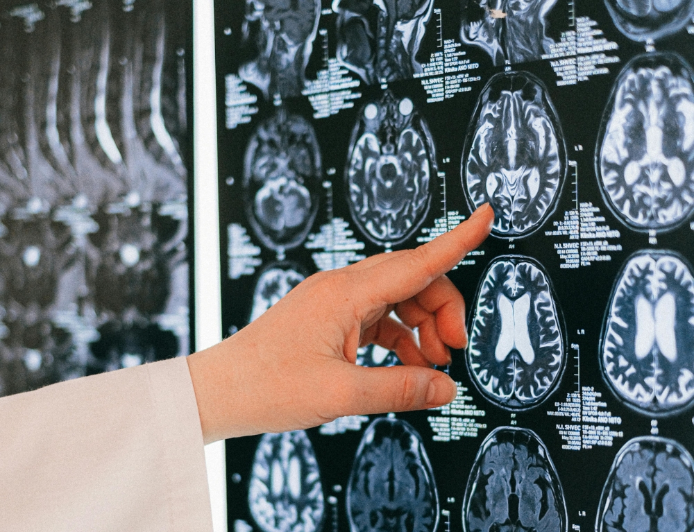 Stroke risk in the bathroom: Why it happens and how to stay safe ...