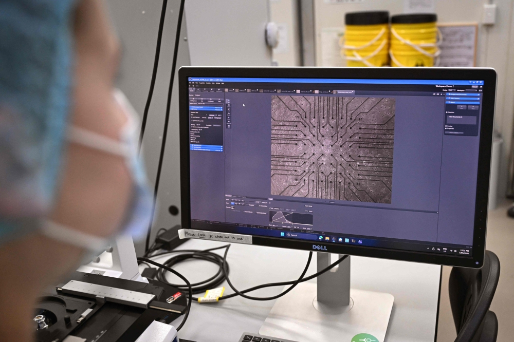 ‘This isn’t wacky science’: Australian researchers teach brain cells to ...