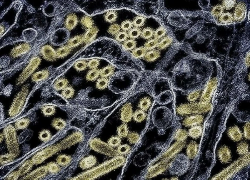 دراسة تحذّر من «تهديد وبائي» وشيك بسبب فايروس مقاوم لمناعة الجسم