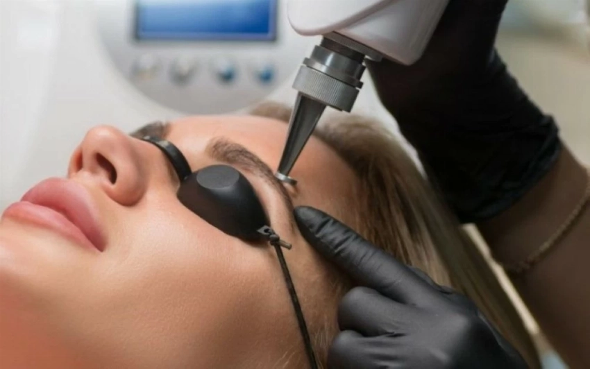 أضرار تشقير الحواجب بالليزر وفق خبراء الجلدية