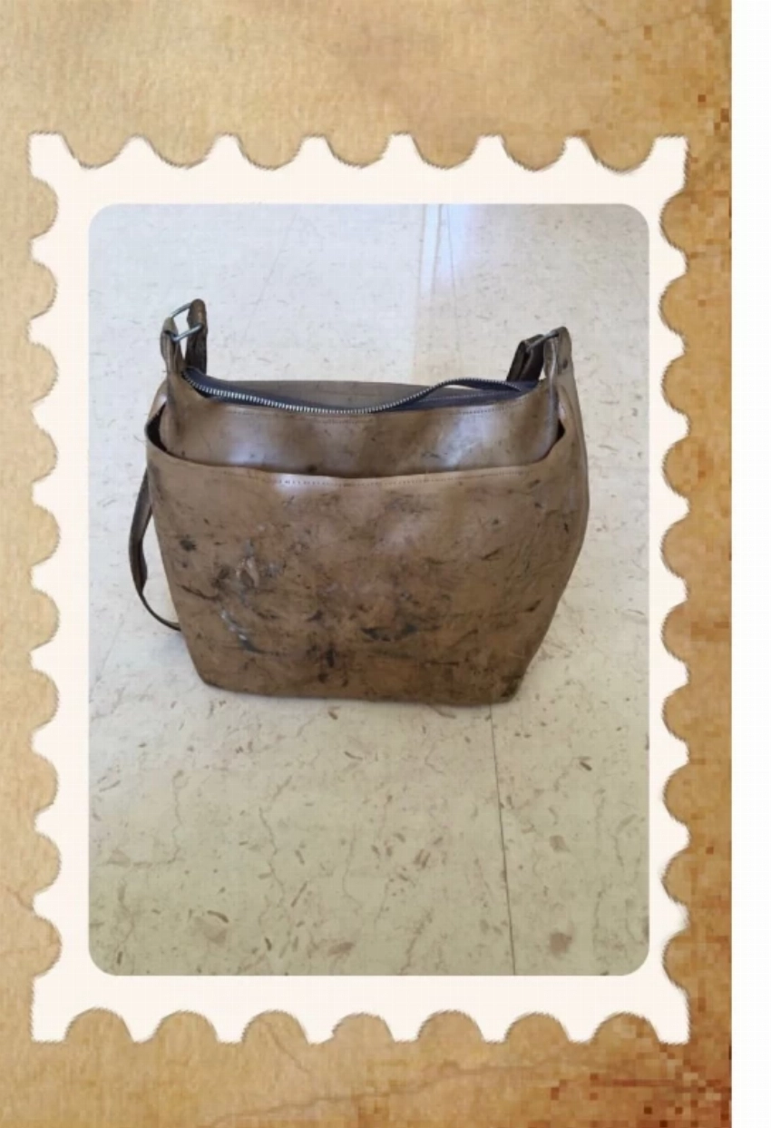 الحقيبة الجلدية رافقته في رحلات العلاج