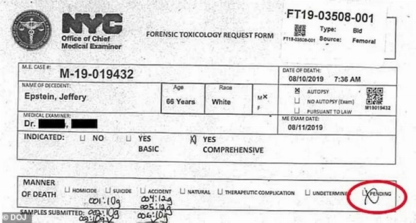 «خُنق أم شُنق».. خبير تشريح يعيد فتح ملف وفاة إبستين بعد 7 سنوات