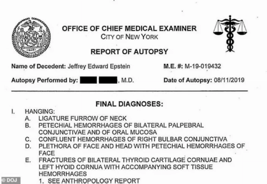 «خُنق أم شُنق».. خبير تشريح يعيد فتح ملف وفاة إبستين بعد 7 سنوات