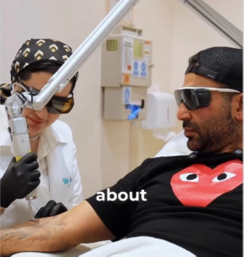 الفنان أحمد سعد أثناء خضوعه لإزالة الوشم من ذراعه.