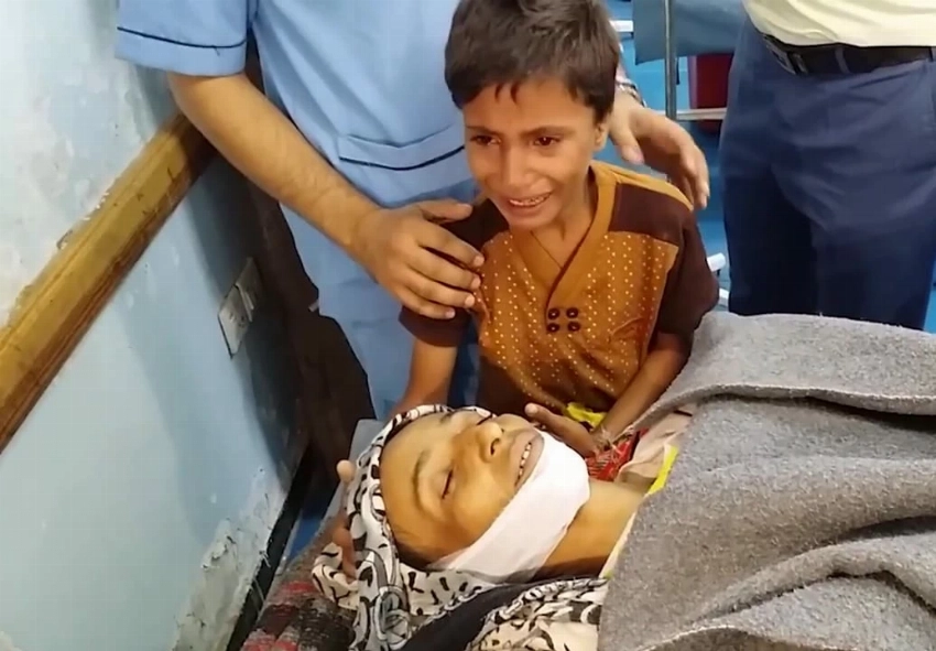 من ضحايا القنص الحوثي.